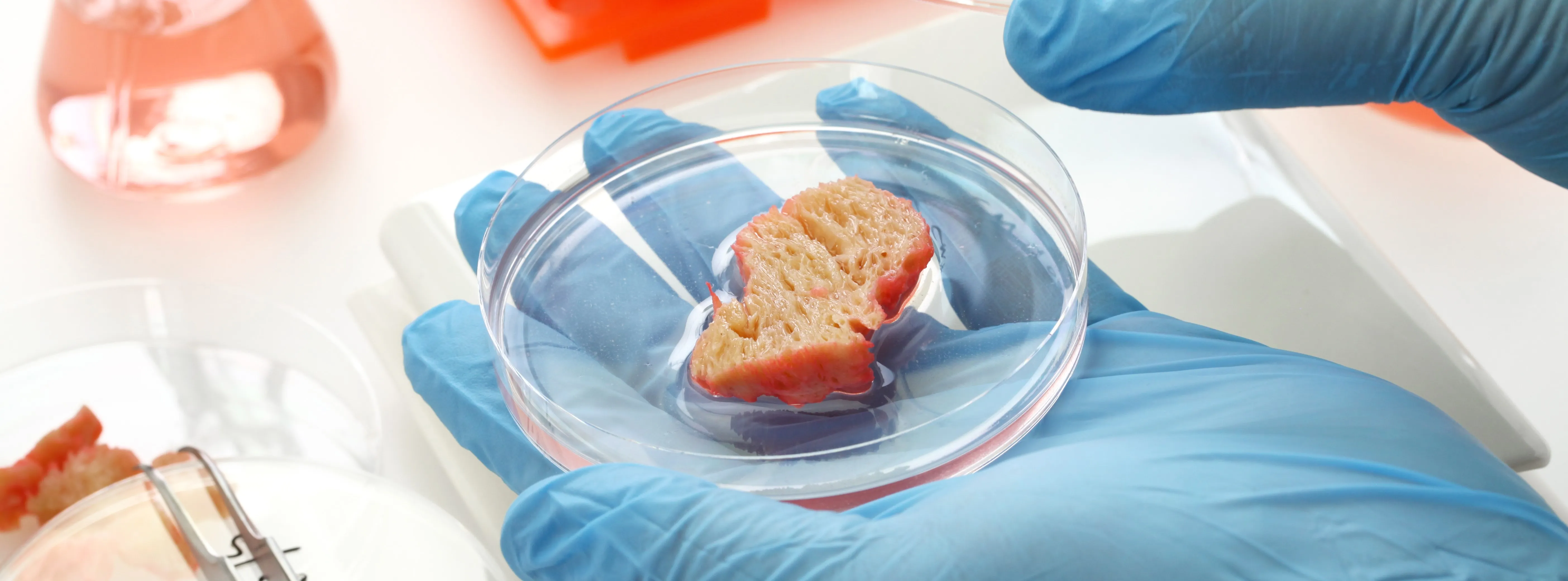 gluten testing in lab